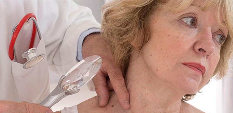 7 Skin Cancer Symptoms You Can’t See