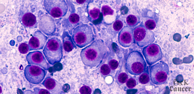Multiple Myeloma Cancer Awareness Month