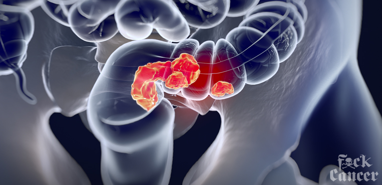 Colorectal Cancer Awareness Month
