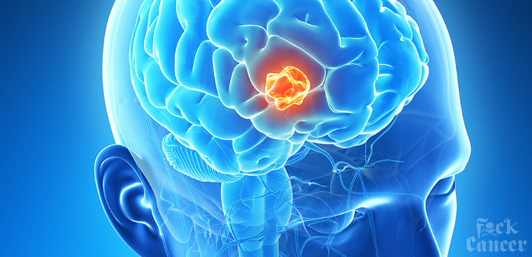 Brain Cancer Awareness