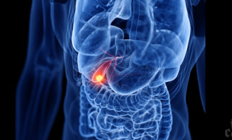 gallbladder cancer image